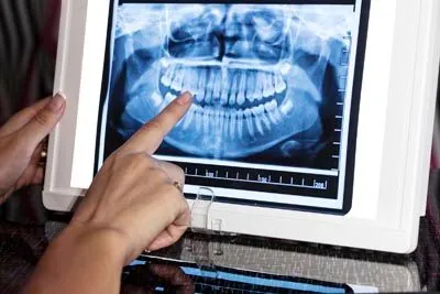 person reviewing a patient's dental x-rays