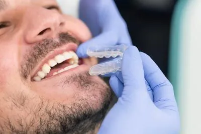man getting fitted for his new Invisalign clear aligners